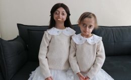 Progeria ile mücadele eden kardeşler hayata umutlu bakıyor