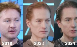 Yaşlanmaya karşı savaş açtı… Görenler tanıyamıyor